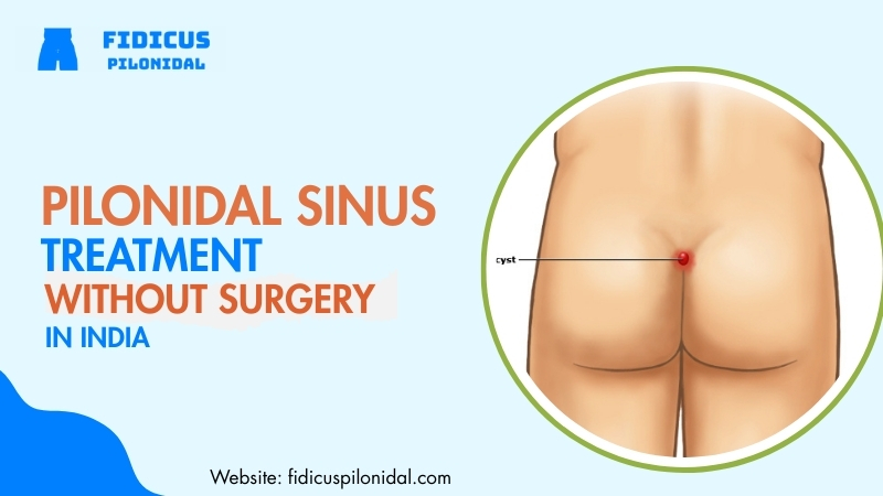Pilonidal Sinus Treatment Without Surgery