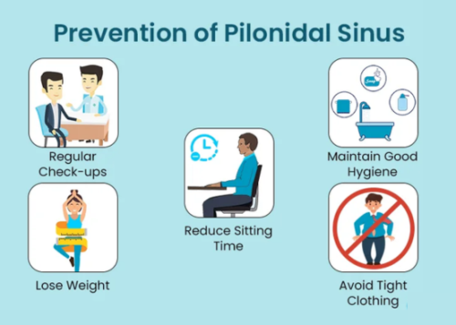 pilonidal sinus medicine