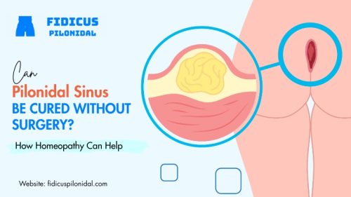 pilonidal sinus surgery types​