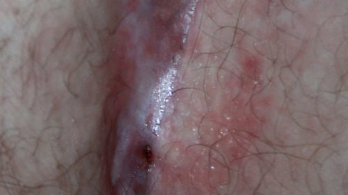 recurrence tendency recurrence tendency